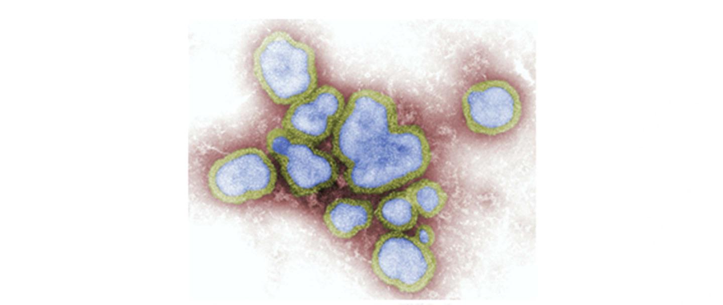 Swine Mutaties en recombinaties 1 2880 x 1216 .jpg